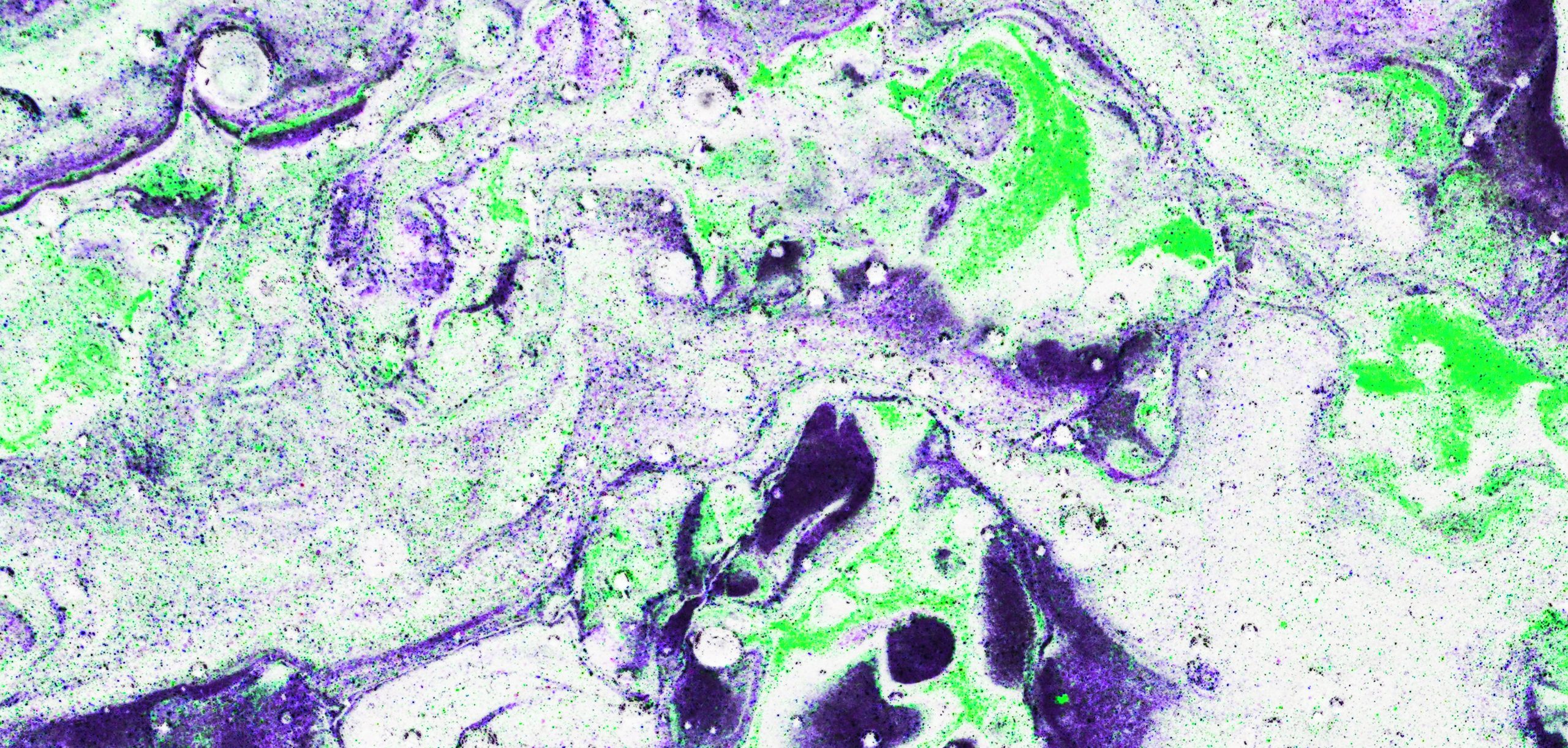 Debunking Common Misconceptions about HPV and HPV Testing