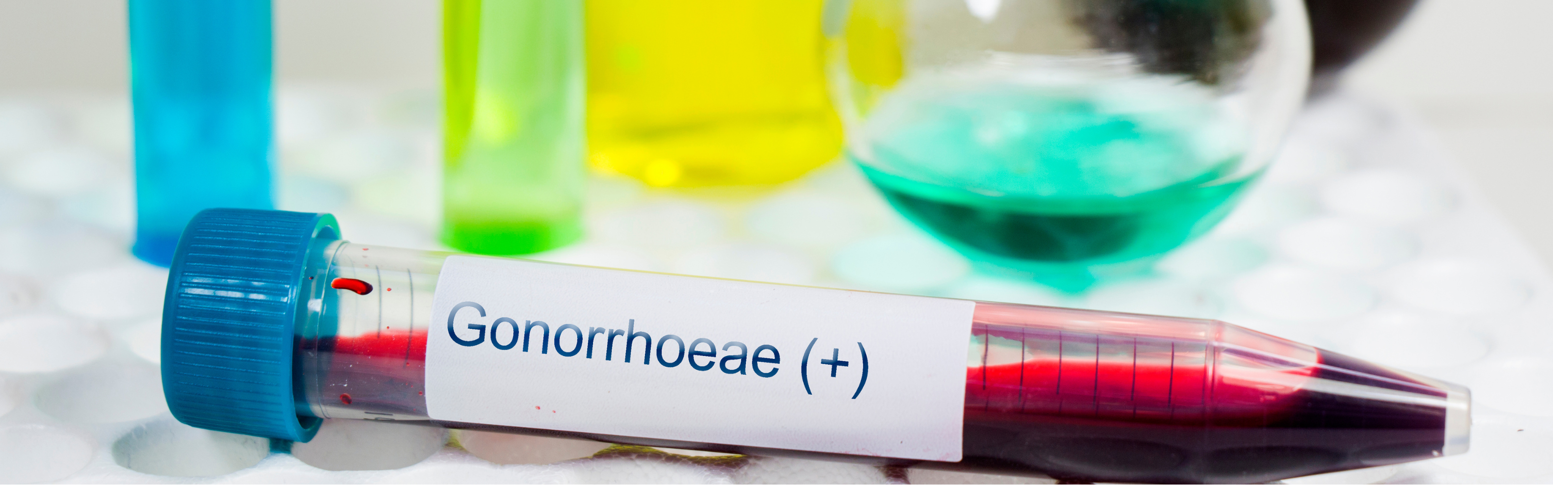 What Are Real Gonorrhea and Chlamydia?