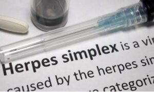 โรคเริมที่อวัยวะเพศ