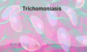 พยาธิในช่องคลอด
